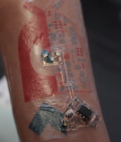 Tatuaje electrónico